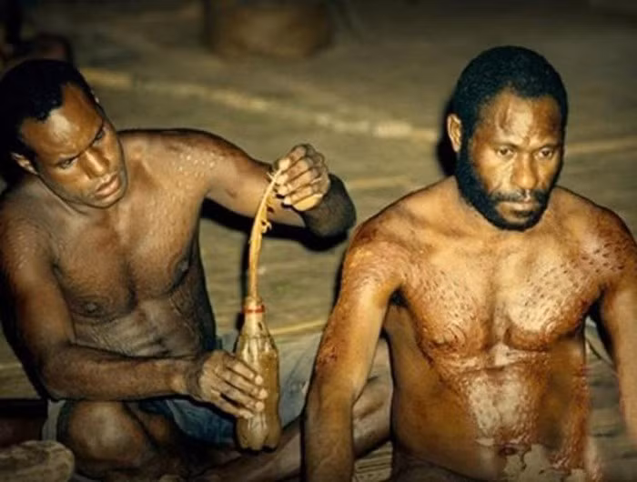 Để đánh dấu sự trưởng thành, các bộ tộc sống dọc sông Sepik ở Papua New Guinea sẽ tham gia một nghi lễ truyền thống - rạch cơ thể. Theo đó, các chàng trai sẽ lần lượt được trưởng tộc trong làng dùng dụng cụ được vót nhọn, rạch dọc sống lưng, ngực, mông để có làn da thô ráp giống những con cá sấu