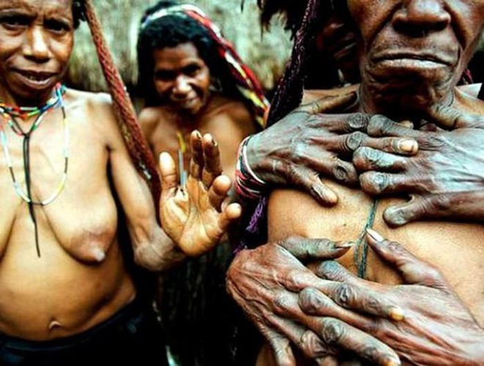 Hủ tục cắt ngón tay được người Dani gọi là Ikipalin. Mỗi khi có một người thân trong gia đình mất đi thì đồng nghĩa với việc người phụ nữ trong gia đình đó sẽ phải chặt đứt một hay hai đốt ngón tay. Người Dani quan niệm, việc người thân mất đi không chỉ là nỗi đau tinh thần mà còn là nỗi đau về thể xác. Số lượng đốt ngón tay mất đi, đồng nghĩa với việc người phụ nữ đó đã mất từng ấy người thân. Một số người cả 10 ngón tay đều bị cụt sau khi nhiều thành viên trong gia đình qua đời.