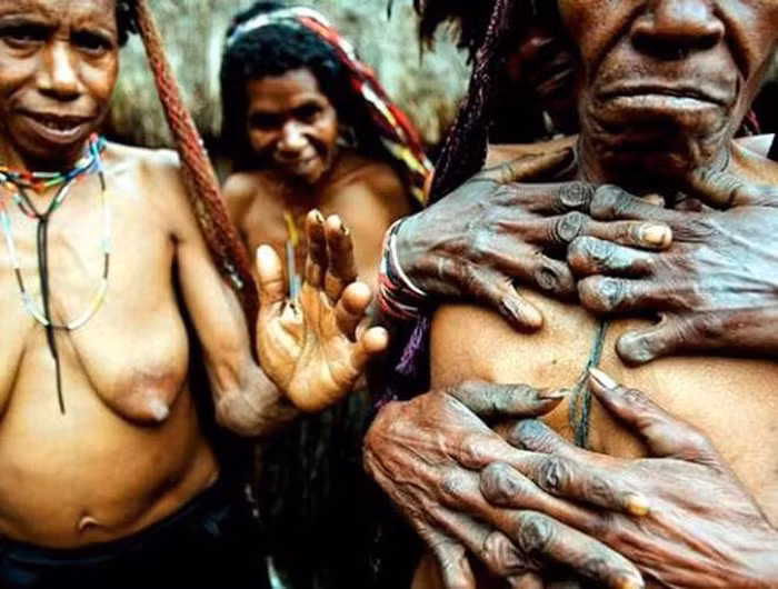 Hủ tục cắt ngón tay được người Dani gọi là Ikipalin. Mỗi khi có một người thân trong gia đình mất đi thì đồng nghĩa với việc người phụ nữ trong gia đình đó sẽ phải chặt đứt một hay hai đốt ngón tay. Người Dani quan niệm, việc người thân mất đi không chỉ là nỗi đau tinh thần mà còn là nỗi đau về thể xác. Số lượng đốt ngón tay mất đi, đồng nghĩa với việc người phụ nữ đó đã mất từng ấy người thân. Một số người cả 10 ngón tay đều bị cụt sau khi nhiều thành viên trong gia đình qua đời.