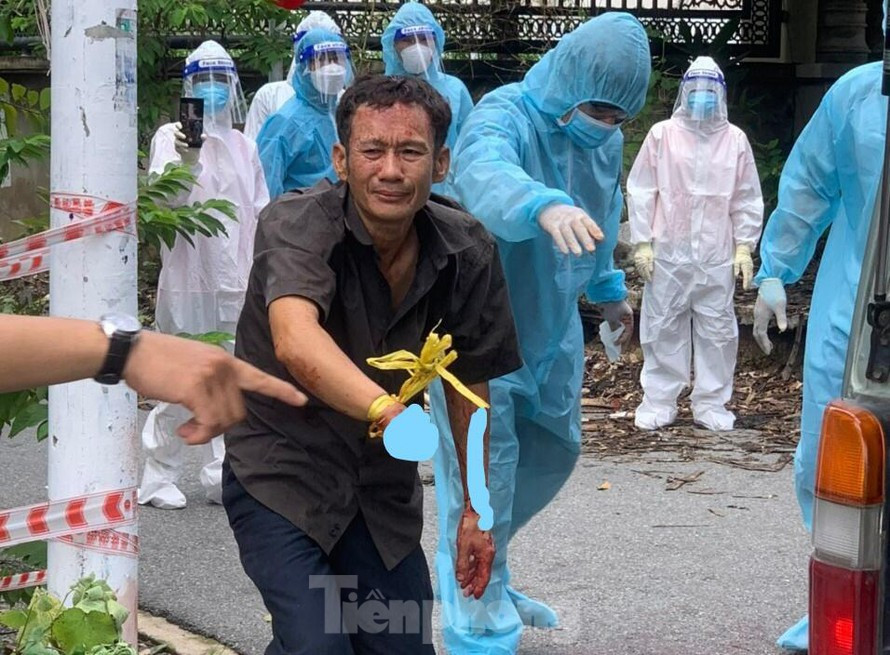  Bị chém đứt lìa bàn tay: Ông V.Đ.K (SN 1972) đang đứng ở hẻm đường Lê Hồng Phong, phường Phú Hòa, TP Thủ Dầu Một thì bị một người đàn ông chưa rõ danh tính dùng mã tấu chém đứt lìa bàn tay phải. Ông K được “hiệp sĩ bóng đêm” Lê Anh Tuấn dùng xe cấp cứu miễn phí đưa đến bệnh viện Chấn thương chỉnh hình TP.HCM nhưng do quá “thời gian vàng” nên bệnh viện thông báo không thể nối được cánh tay bị đứt lìa. 