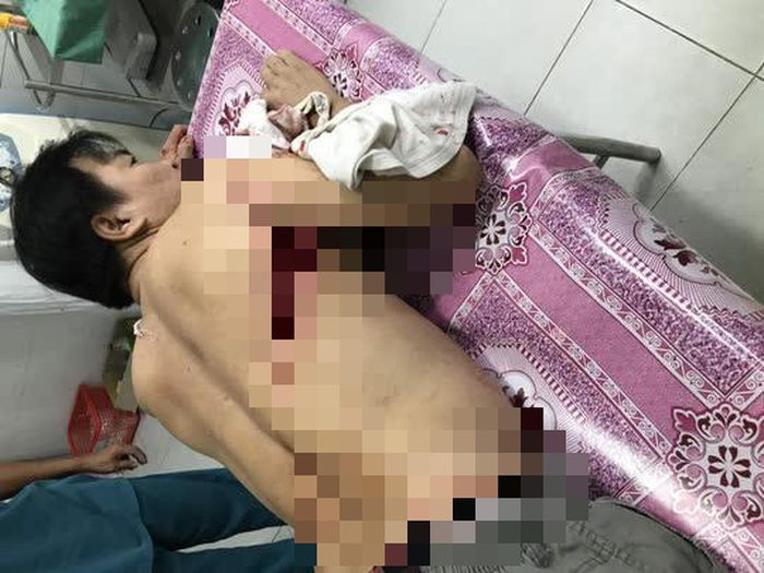 Chem nguoi hang xom suyt chet de… tra “moi thu” 10 nam truoc-Hinh-4