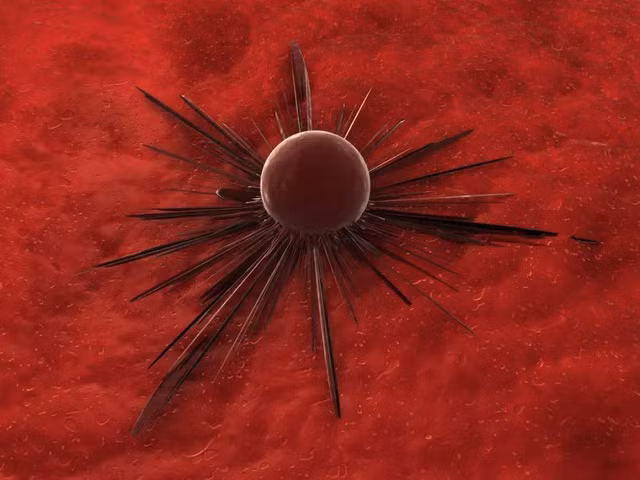 Tu kham ban than: Nguoi co 5 dac diem nay, de bi ung thu tan cong-Hinh-5