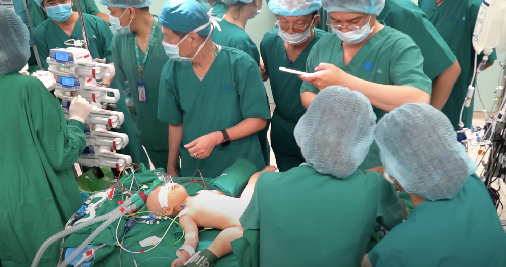 Tach thanh cong cap song sinh dinh lien o TP HCM