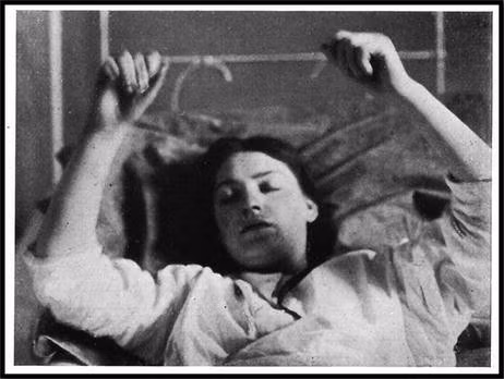 2. Hội chứng rối loạn giấc ngủ Encephalitis Lethargica (1916-1927): Gây ra tình trạng mệt mỏi, ngủ liên tục và thậm chí hôn mê, dịch bệnh này ảnh hưởng đến hàng triệu người trên toàn thế giới. (Ảnh:SpringerLink)