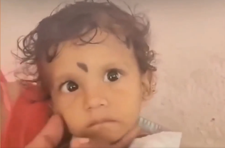 Con rắn được xác định là loài rắn mù Brahminy, một loài rắn nhỏ không có nọc độc, trông giống như giun. Gia đình đã chôn con rắn ở sân sau.