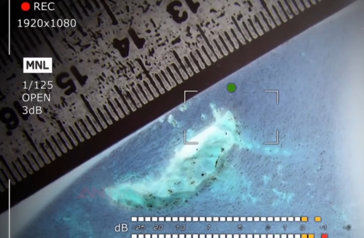 Khám nghiệm tử thi xác định ông Nhất bị bắn 1 phát vào hông bên phải, đạn xuyên qua hông trái làm tổn thương vùng nội tạng khiến ông tử vong tại chỗ.