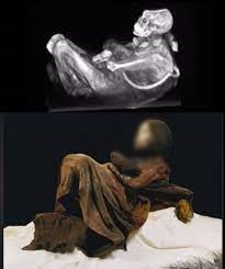 Trước đó, nhà thám hiểm National Geographic, ông Johan Reinhard phát hiện xác ướp thiếu nữ Inca trên đỉnh núi Ampato cao 6.400m thuộc dãy Andes trong cuộc viễn chinh năm 1995. Về sau, các nhà nghiên cứu gọi là xác ướp Trinh nữ băng Ampato hoặc xác ướp Juanita.