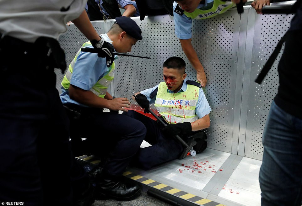 Những hình ảnh được đăng tải trên mạng cho nhất một cảnh sát bị chảy máu trên mặt và được đồng nghiệp đưa đến nơi an toàn. Một người biểu tình cũng bị thương.