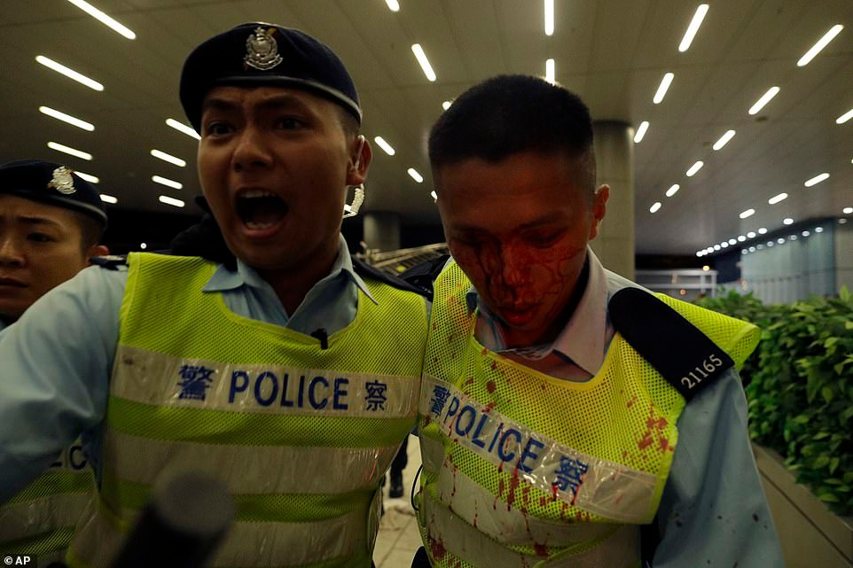 Một cảnh sát bị thương ở mặt được đưa đi.