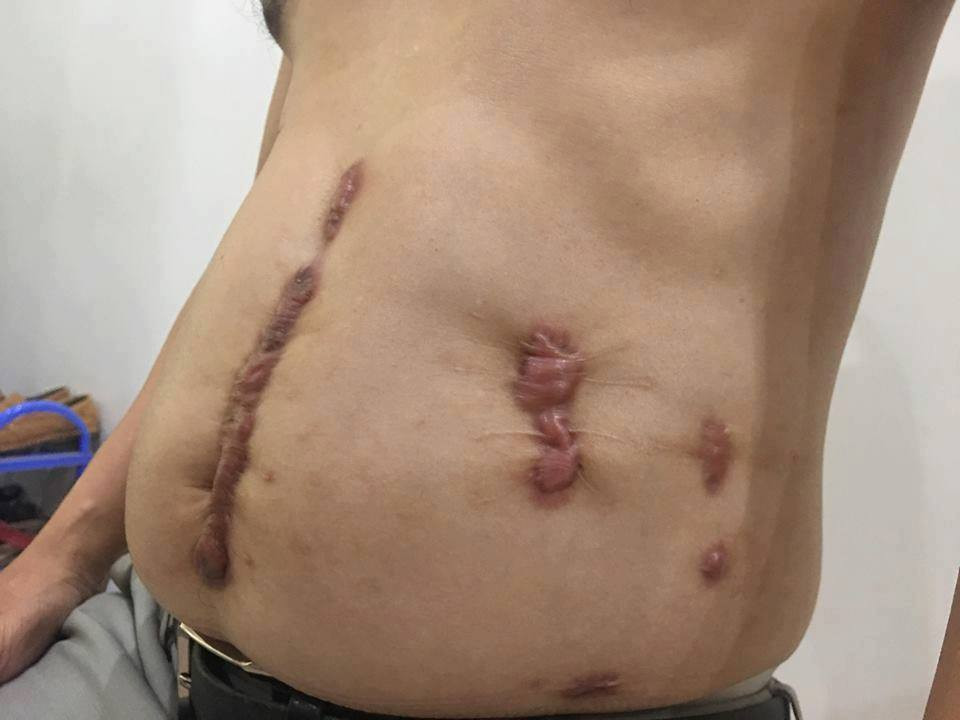 Bi dam nhieu nhat khi di mua sung phong than