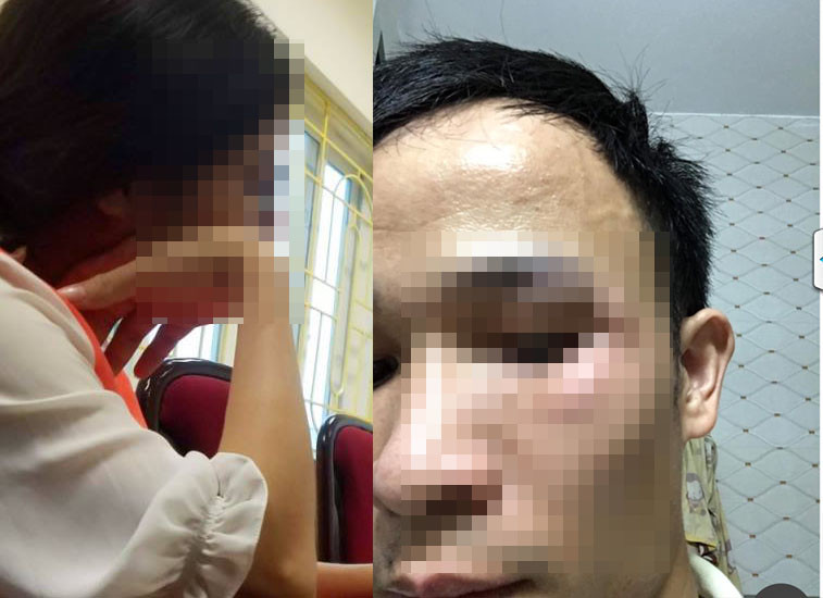 De nghi khoi to thanh nien tan cong phu nu mang bau o Ha Noi-Hinh-2