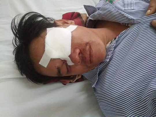 Khởi tố thiếu nữ 23 tuổi cho vay nặng lãi, đâm mù mắt con nợ Khoi to thieu nu 23 tuoi cho vay nang lai, dam mu mat con no