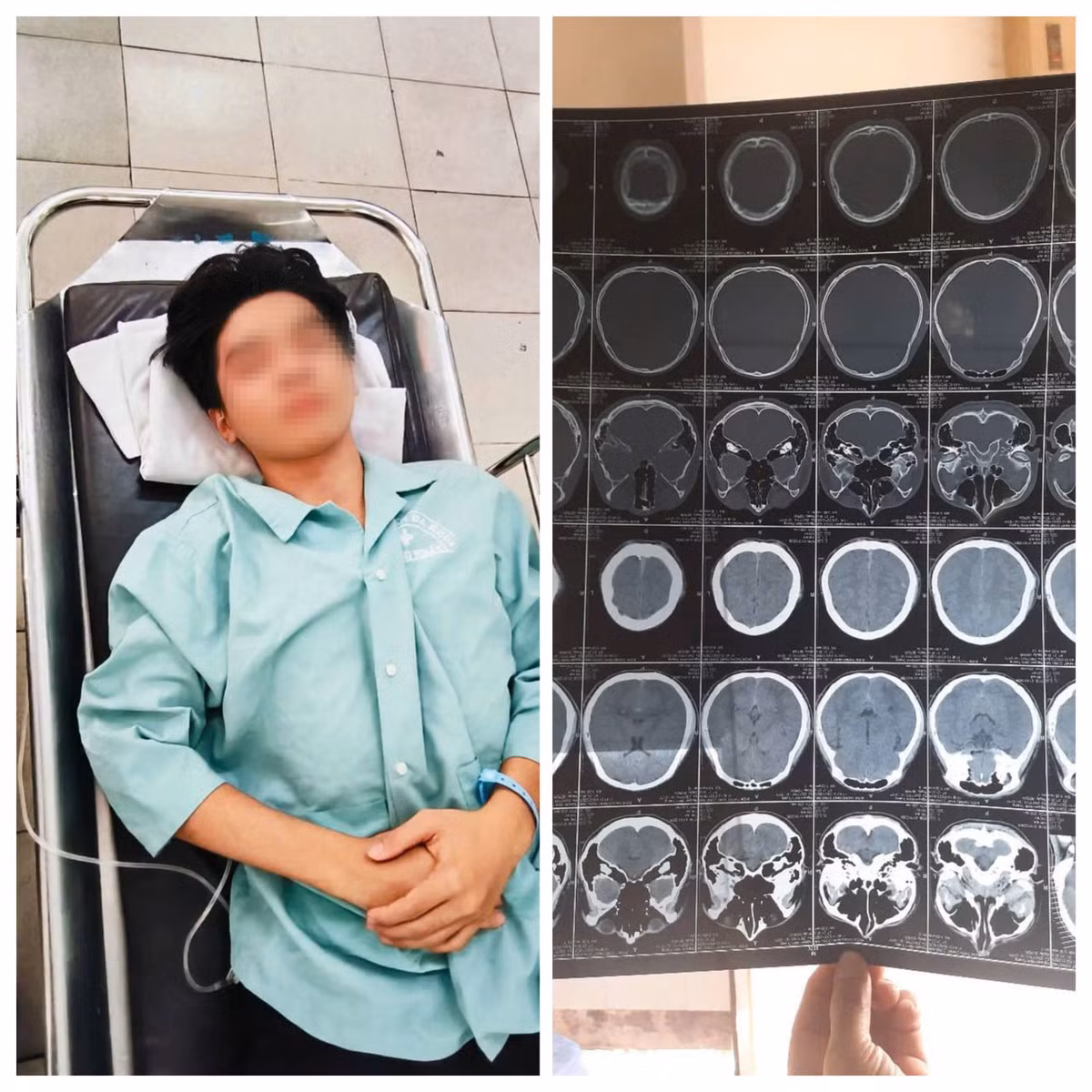 Vu nam sinh bi hanh hung nut so nao: Nghi do mau thuan tinh cam-Hinh-2