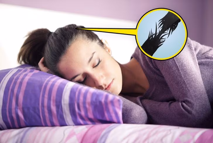 Tóc dễ gãy rụng: Buộc tóc chặt và cao liên tục bằng dây chun sẽ làm tóc yếu đi. Lực căng có thể làm đứt các sợi tóc. Tình trạng sẽ tệ hơn khi bạn buộc tóc đuôi ngựa đi ngủ.