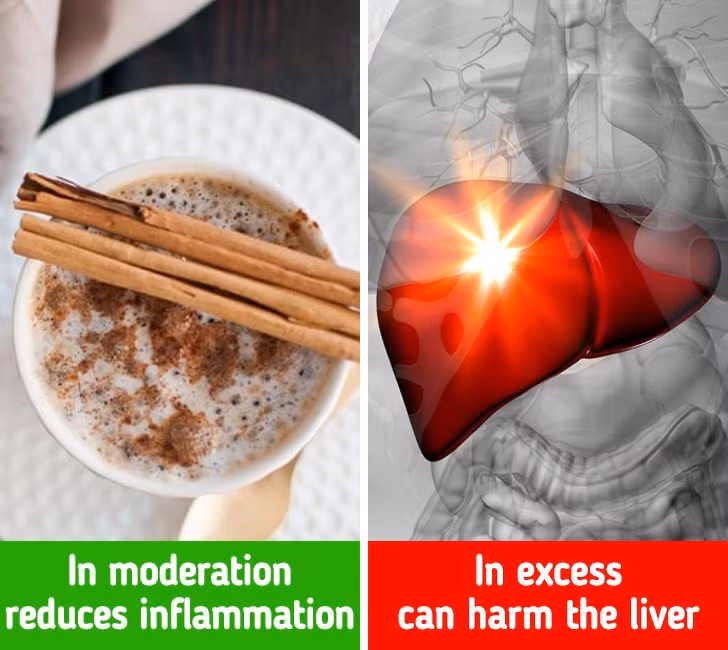 Quế: Gia vị này được coi là một siêu thực phẩm có nhiều công dụng chữa bệnh như làm giảm lượng đường trong máu, giảm viêm và ngăn ngừa bệnh tim. Tuy nhiên, nghiên cứu đã chỉ ra rằng ăn quá nhiều quế có thể gây ngộ độc do chứa coumarin. Coumarin đặc biệt nguy hiểm đối với những người có vấn đề về gan và có thể gây tổn thương gan khi hấp thụ quá nhiều.