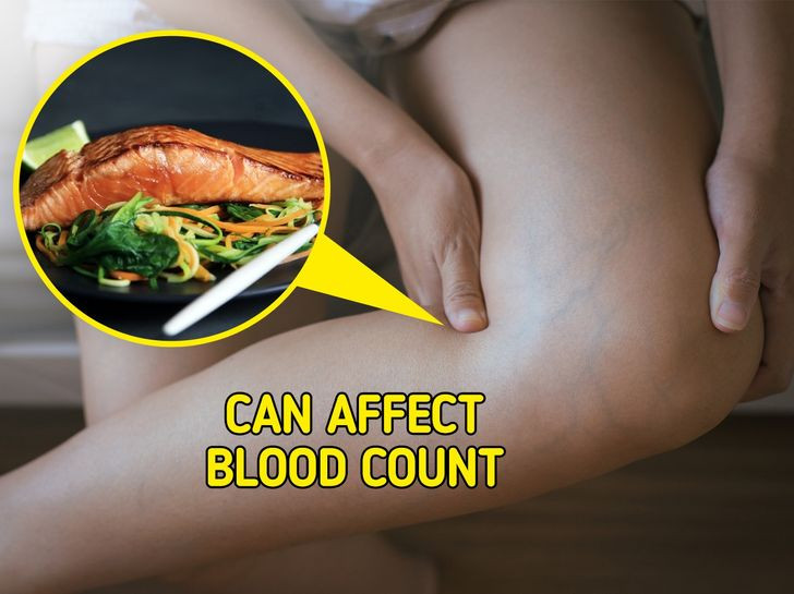 Cá hồi: Siêu thực phẩm này cung cấp protein nạc và axit béo omega-3 rất tốt, giúp chống viêm. Mặc dù cá hồi rất tốt cho sức khỏe nhưng việc tiêu thụ quá nhiều omega-3 có thể có tác động tiêu cực đến số lượng tiểu cầu trong máu và thậm chí có thể làm loãng máu. Ngoài ra, các nghiên cứu đã phát hiện ra rằng ăn quá nhiều cá, kể cả cá hồi, có thể làm tăng nồng độ thủy ngân trong máu.