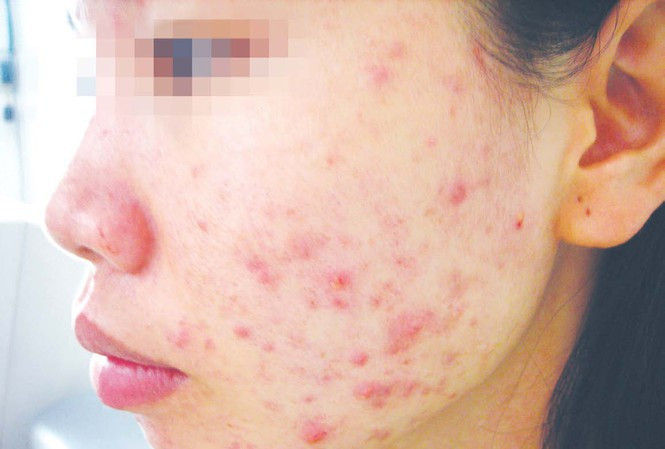 Sat Tet, chi em lai khon don vi my pham gia