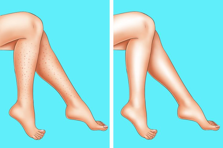 Vùng da vừa cạo lông: Sau khi cạo, wax lông nếu không có các sản phẩm làm dịu chuyên dụng bạn có thể thoa một lớp mỏng lăn khử mùi có tác dụng làm dịu da. Tuy nhiên, trường hợp này nên hạn chế các sản phẩm chứa cồn, chứa hương liệu mạnh để không gây kích ứng da.