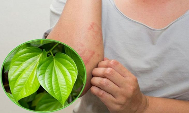 Trong trường hợp mề đay gây ngứa nhẹ, bạn có thể áp dụng cách chữa bằng lá trầu để kiểm soát các triệu chứng khó chịu. Rửa sạch 2 nắm lá trầu không và cắt nhỏ hoặc vò xát để tinh dầu từ trầu không tỏa mùi thơm. Đun sôi 1.5 – 2 lít nước rồi cho lá trầu vào, tắt bếp và đậy kín nắp trong 10 – 15 phút. Đổ nước ra thau, hòa thêm nước mát và dùng tắm hằng ngày.