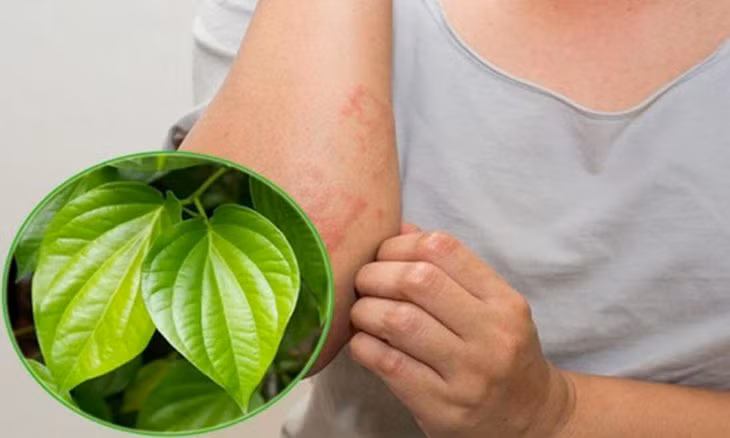 Trong trường hợp mề đay gây ngứa nhẹ, bạn có thể áp dụng cách chữa bằng lá trầu để kiểm soát các triệu chứng khó chịu. Rửa sạch 2 nắm lá trầu không và cắt nhỏ hoặc vò xát để tinh dầu từ trầu không tỏa mùi thơm. Đun sôi 1.5 – 2 lít nước rồi cho lá trầu vào, tắt bếp và đậy kín nắp trong 10 – 15 phút. Đổ nước ra thau, hòa thêm nước mát và dùng tắm hằng ngày.