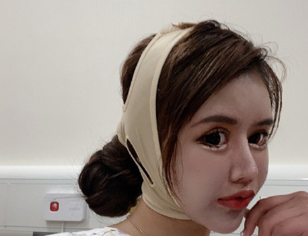 Theo China Youth Daily, Tiểu Z công khai đăng "Nhật ký phẫu thuật thẩm mỹ" tại Weibo cá nhân từ tháng 3/2020. Những chia sẻ về hành trình dao kéo đã khiến lượng người theo dõi cô tăng chóng mặt. Cô nàng tự gọi mình là "người trẻ tuổi phẫu thuật thẩm mỹ nhiều nhất Trung Quốc".