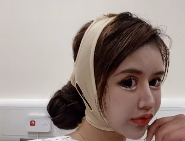 Theo China Youth Daily, Tiểu Z công khai đăng "Nhật ký phẫu thuật thẩm mỹ" tại Weibo cá nhân từ tháng 3/2020. Những chia sẻ về hành trình dao kéo đã khiến lượng người theo dõi cô tăng chóng mặt. Cô nàng tự gọi mình là "người trẻ tuổi phẫu thuật thẩm mỹ nhiều nhất Trung Quốc".