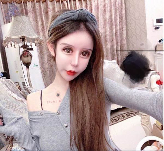 Tính đến nay, khi đã 16 tuổi, Tiểu Z Na Na đã trải qua 100 cuộc phẫu thuật thẩm mỹ, tiêu tốn hơn 1 triệu nhân dân tệ (hơn 3,3 tỉ đồng). Tuy nhiên, có nhiều nguồn tin hot girl Hoa ngữ này chỉ mới phẫu thuật hơn 60 lần, nhưng cũng có nơi khẳng định cô “đụng chạm” cơ thể đến gần 300 lần, tính luôn các cuộc tiểu phẫu.