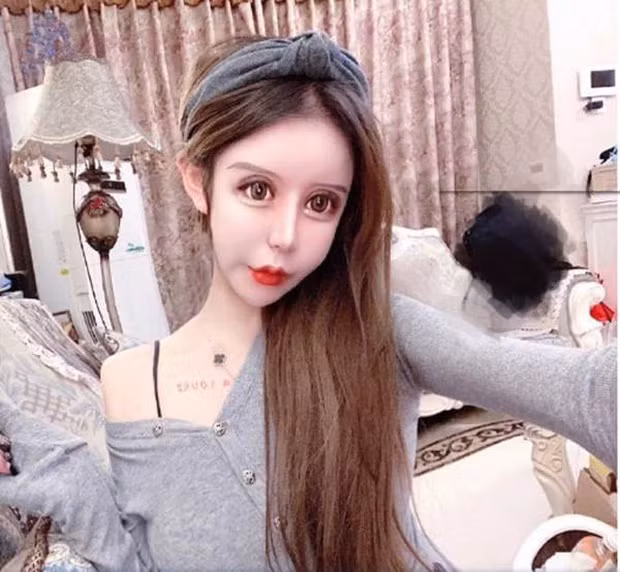 Tính đến nay, khi đã 16 tuổi, Tiểu Z Na Na đã trải qua 100 cuộc phẫu thuật thẩm mỹ, tiêu tốn hơn 1 triệu nhân dân tệ (hơn 3,3 tỉ đồng). Tuy nhiên, có nhiều nguồn tin hot girl Hoa ngữ này chỉ mới phẫu thuật hơn 60 lần, nhưng cũng có nơi khẳng định cô “đụng chạm” cơ thể đến gần 300 lần, tính luôn các cuộc tiểu phẫu.