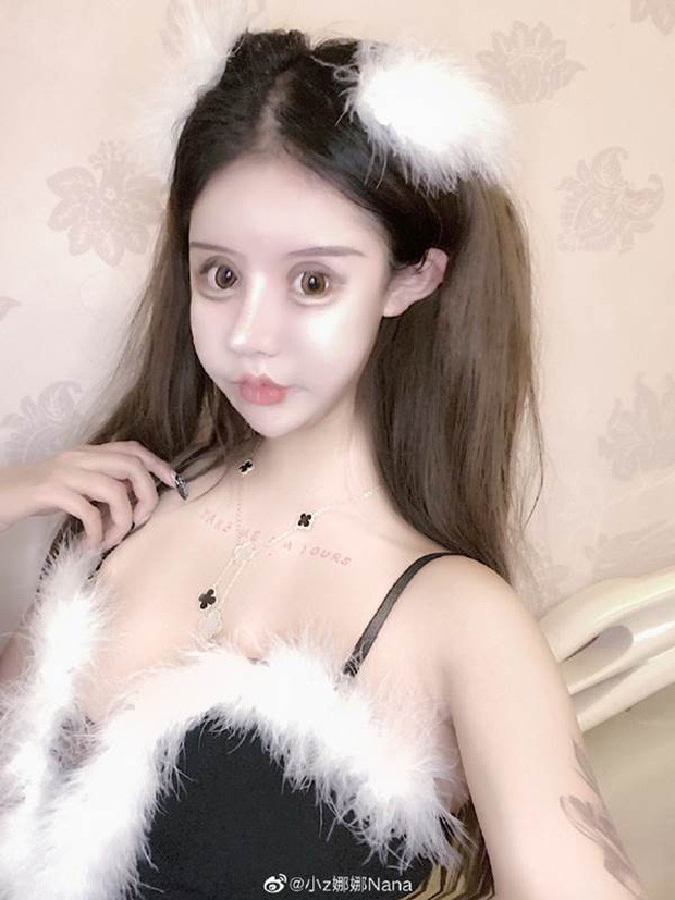 Chỉ cần cảm thấy có điều gì đó không ổn trên khuôn mặt của mình, hoặc thậm chí tìm thấy một "khuyết điểm" sau khi chụp ảnh tự sướng, Tiểu Z lập tức chọn thẩm mỹ để thay đổi nó.