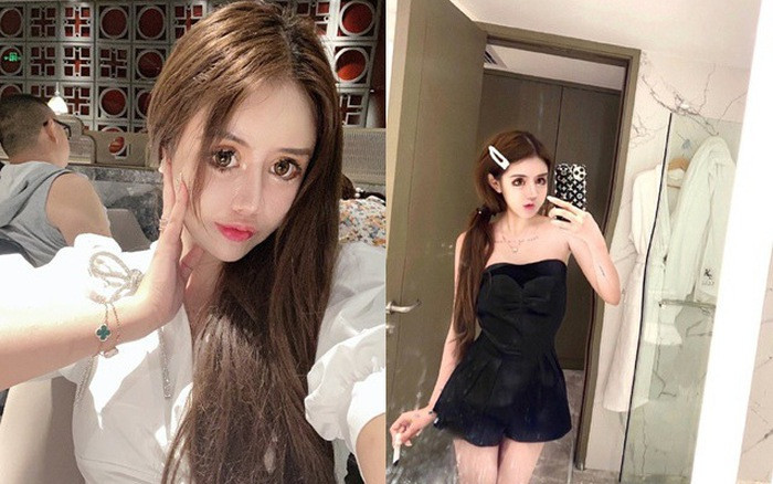 Dù chịu nhiều biến chứng, Tiểu Z từng nói cô không hối hận và vẫn muốn tiếp tục chỉnh sửa nhan sắc trong tương lai. Ảnh: Internet.