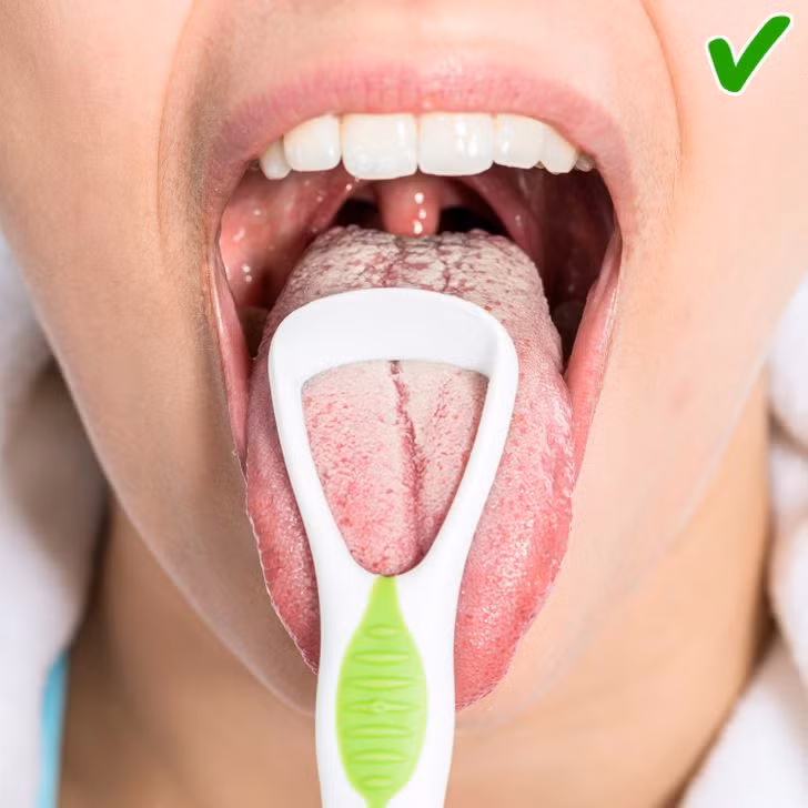 6. Dùng dụng cụ cạo lưỡi: Cạo từ phía sau lưỡi và nếu bạn nhận thấy lớp phủ trên lưỡi có màu trắng, thì điều đó có nghĩa là rất nhiều mảnh vụn từ thức ăn, vi khuẩn hoặc tế bào chết đã tập trung ở đó. Lưỡi hồng và trong là dấu hiệu của sức khỏe răng miệng tốt.