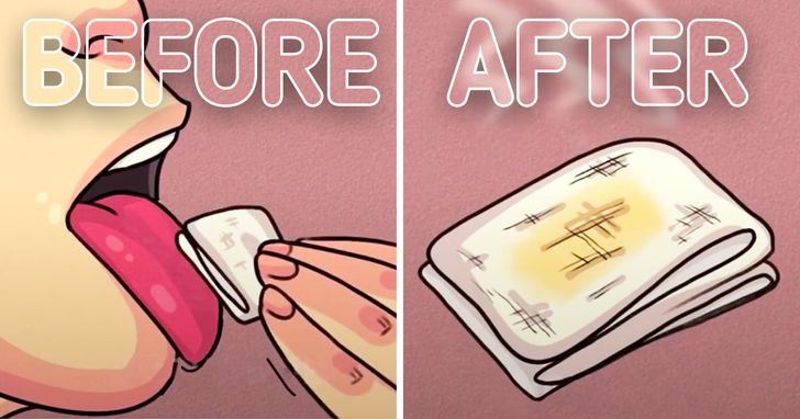 4. Lau bề mặt lưỡi bằng một miếng gạc: Dùng gạc sạch lau bề mặt lưỡi của bạn, sau đó nhìn vào miếng gạc. Nó có lớp phủ màu vàng không? Điều đó có nghĩa là hơi thở có mùi và nó là do sản xuất sunfua ở mức độ cao. Bạn cũng có thể thử nghiệm bằng khăn giấy.