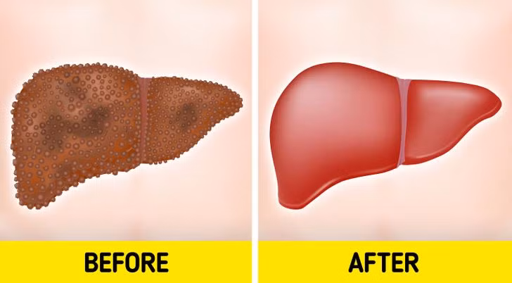 6. Gan hoạt động hiệu quả hơn: Có thông tin cho rằng ăn quả bơ có thể giúp giảm tổn thương gan, vì vậy, thêm loại trái cây này vào chế độ ăn uống của bạn là một lựa chọn tốt.