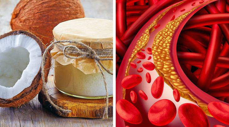 9. Dầu dừa: Mặc dù dầu dừa có nhiều đặc tính riêng, nhưng tốt hơn hết bạn không nên ăn nó thường xuyên. Dầu dừa có xu hướng làm tăng mức cholesterol và có thể làm tăng nguy cơ mắc bệnh tim.
