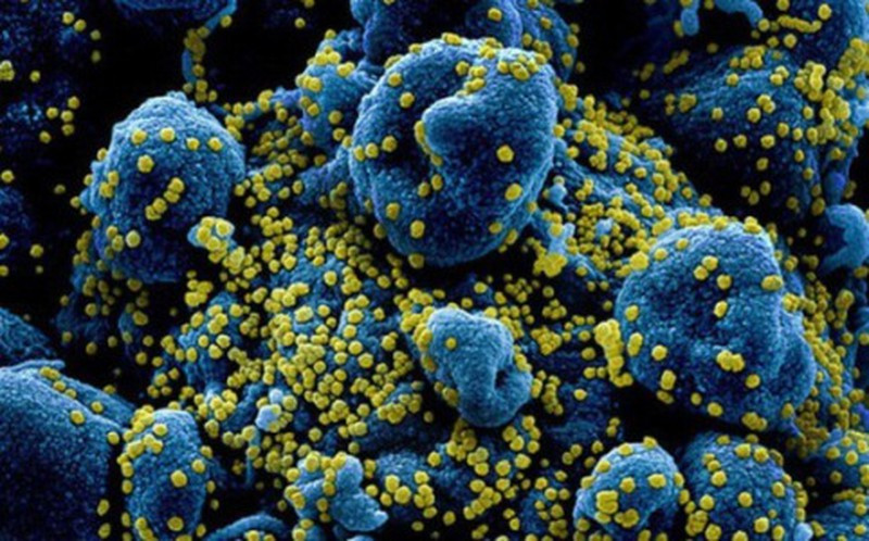 BN COVID-19 o HN bi “bao cytokine” nguy hiem the nao?