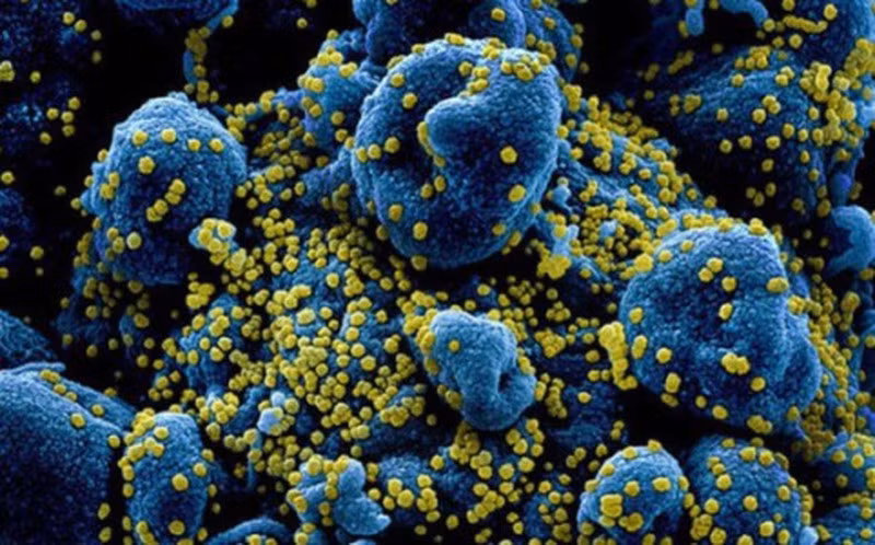 BN COVID-19 o HN bi “bao cytokine” nguy hiem the nao?