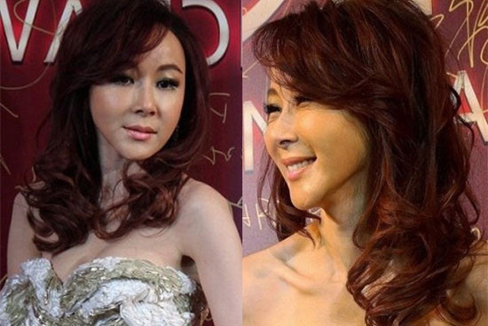 Tiêu Tường: Nhiều ý kiến cho rằng, Tiêu Tường đã sử dụng chất làm đầy quá đà khiến gương mặt cứng đơ như tượng sáp và chiếc cằm méo mó khó nhìn. Cô đào nổi tiếng xứ Đài ngày nào giờ đã bị "dao kéo vùi dập" nhan sắc.