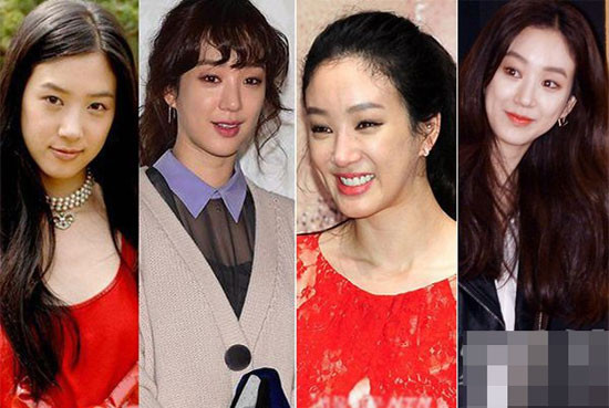 Jung Ryeo Won: Khán giả không khỏi ngỡ ngàng vì khuôn mặt cứng, môi sưng phồng, đường nét thiếu tự nhiên trên gương mặt của Jung Ryeo Won. Cô bị liệt vào danh sách "thảm họa thẩm mỹ" của các ngôi sao nữ châu Á.