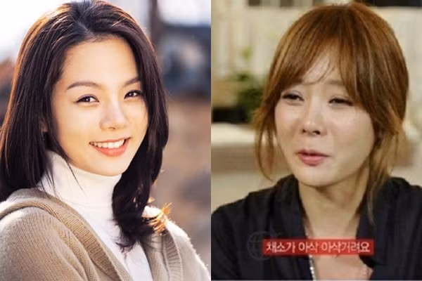 Chae Rim bị gọi là thảm họa thẩm mỹ của làng giải trí Hàn. Mặc dù khi được hỏi về nghi vấn phẫu thuật thẩm mỹ, cô đã lên tiếng bác bỏ nhưng rõ ràng hình ảnh hiện tại khác hoàn toàn với vẻ đẹp của nữ diễn viên này trước đây. Không chỉ có gương mặt sưng phồng, Chae Rim còn để lộ đôi mắt híp và nụ cười thiếu tự nhiên căng cứng, thiếu tự nhiên. 