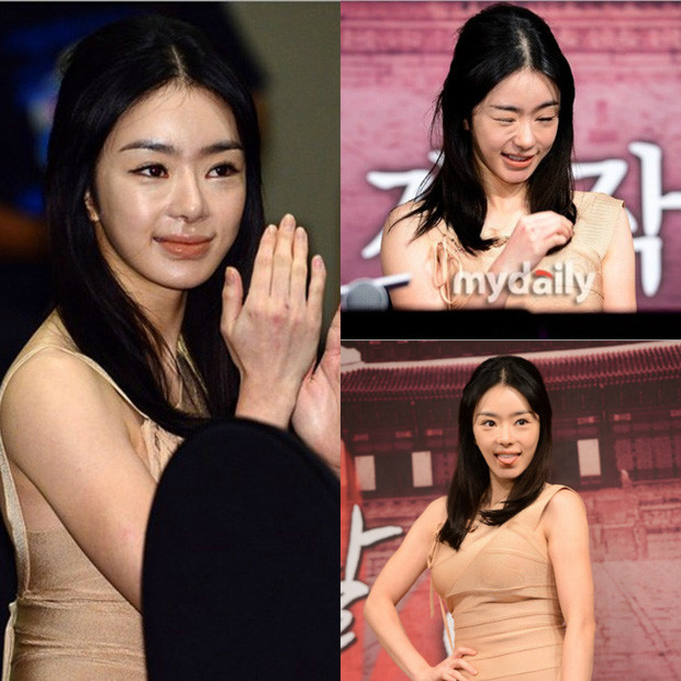 Seo Woo là một trong những mỹ nhân nghiện thẩm mỹ bậc nhất của Kbiz. Đáng tiếc cho Seo Woo là công cuộc thẩm mỹ của cô nàng lại không được thành công như những mỹ nhân khác. Khi xuất hiện trước công chúng, cô thường xuyên bị chê trách vì gương mặt cứng nhắc đến mức đáng sợ.