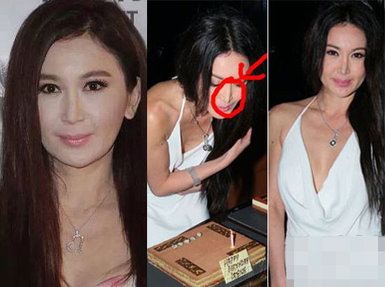 Ôn Bích Hà từng thừa nhận gìn giữ tuổi thanh xuân bằng cách làm trị liệu và tiêm thẩm mỹ. Thời gian gần đây, những di chứng làm đẹp đã khiến mặt cô sưng phồng và sống mũi méo mó.