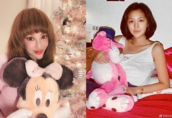 Nữ diễn viên Tiết Chỉ Luân khiến khán giả giật mình vì gương mặt nhọn hoắt, quái dị sau khi trải qua nhiều lần dao kéo. Dung mạo dịu dàng, xinh xắn ngày xưa của cô làm nhiều người tiếc nuối vô cùng.