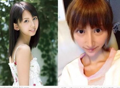 Đam mê mốt gương mặt V line, diễn viên phim nóng Nhật Bản - Rumi Kanda điên cuồng giảm cân, sửa mũi và mắt khiến người ta không thể nhận ra cô.