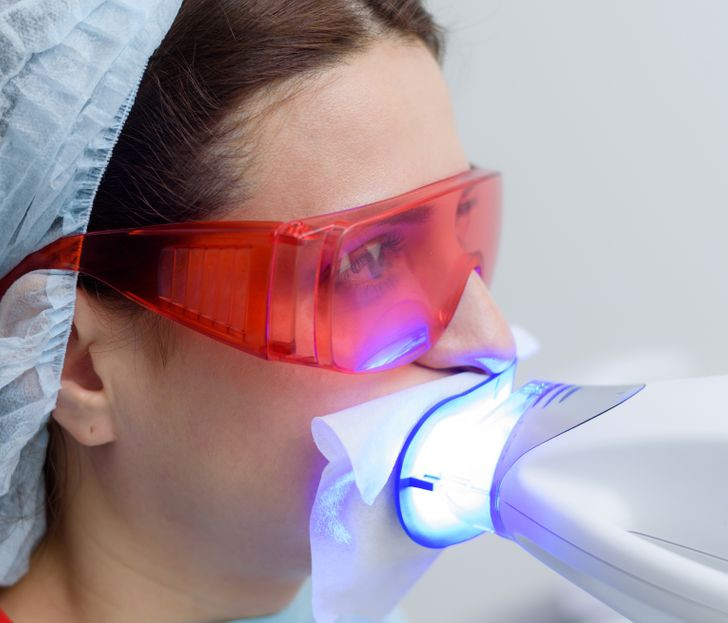 6. Làm trắng răng: Việc làm trắng răng không chỉ gây nghiện mà chứng rối loạn này còn có tên riêng: bleachorexia. Nó có thể được coi là một vấn đề về biến đổi cơ thể, vì mọi người có xu hướng luôn thấy răng của họ bẩn và vàng, ngay cả khi chúng đã trắng hoàn hảo.