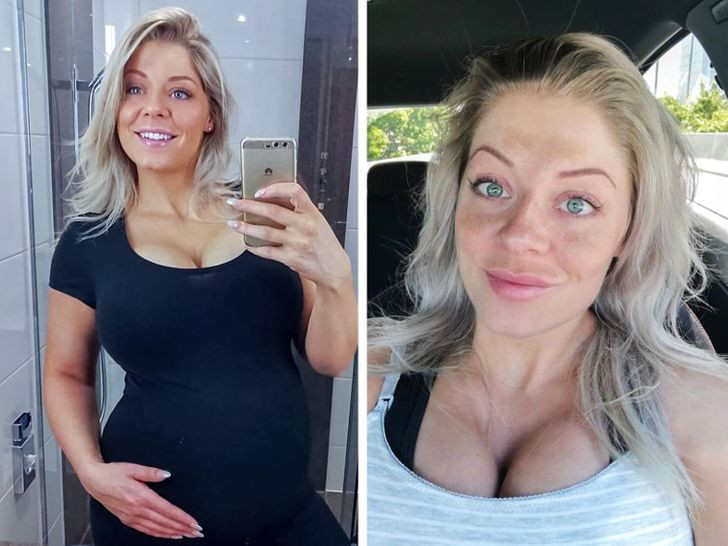 7 nguyen nhan khien mat ban xuat hien tan nhang-Hinh-7