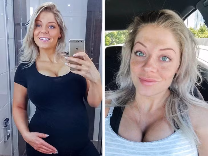 7 nguyen nhan khien mat ban xuat hien tan nhang-Hinh-7