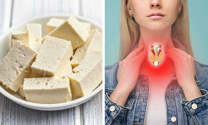 3. Nội tiết tố có thể thay đổi: Mặc dù đậu nành có thể thay thế thịt tốt, nhưng ăn quá nhiều đậu nành có thể có những tác động tiêu cực đến cơ thể của bạn. Điều này có thể xảy ra nếu bạn thường xuyên thay thế protein từ thịt bằng protein đậu nành. Người ta phát hiện ra rằng ăn nhiều đậu nành có thể làm rối loạn tuyến giáp, gây mất cân bằng hormone. Do đó, bạn nên tìm những sản phẩm thay thế khác sẽ tốt cho sức khỏe hơn.