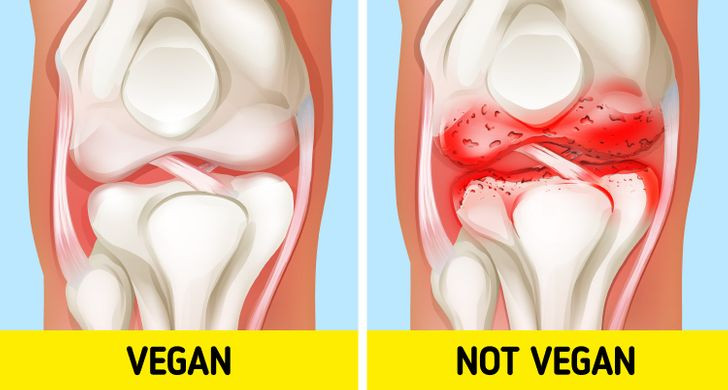 4. Các khớp của bạn ít bị viêm hơn: Thực phẩm như bơ, pho mát và bánh mì kẹp thịt có thể gây viêm khớp vì chúng chứa nhiều chất béo bão hòa. Nghiên cứu mới cho thấy chế độ ăn chay, đặc biệt là thuần chay, có thể giúp giảm các triệu chứng của bệnh viêm khớp dạng thấp. Điều này một phần là do bạn sẽ không ăn nhiều chất béo bão hòa, đồng thời ăn nhiều thức ăn thực sự chống lại chứng viêm.