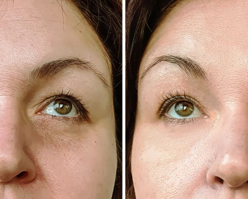 Làm đẹp da: Dầu ô liu là nguyên liệu làm đẹp quen thuộc, cả trong các công thức bôi ngoài da lẫn chế độ ăn giúp làm đẹp da. Thường xuyên tiêu thụ dầu ô liu giúp giảm mẩn đỏ, sưng tấy, bổ sung độ ẩm cho da, giúp hạn chế nếp nhăn.