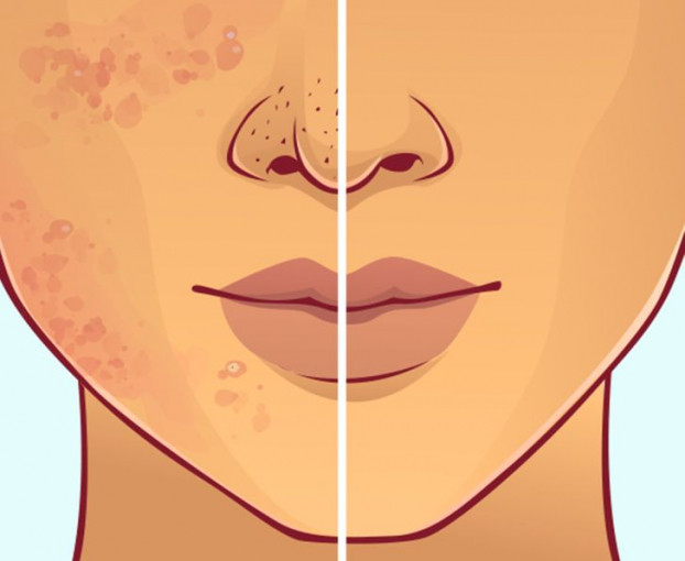 Vi sao ban khong nen xoa toc khi di ngu?-Hinh-2